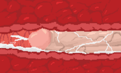 Copy_of_xrayanal4.png